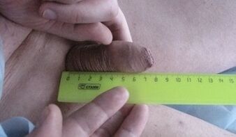 Medición do tamaño do pene